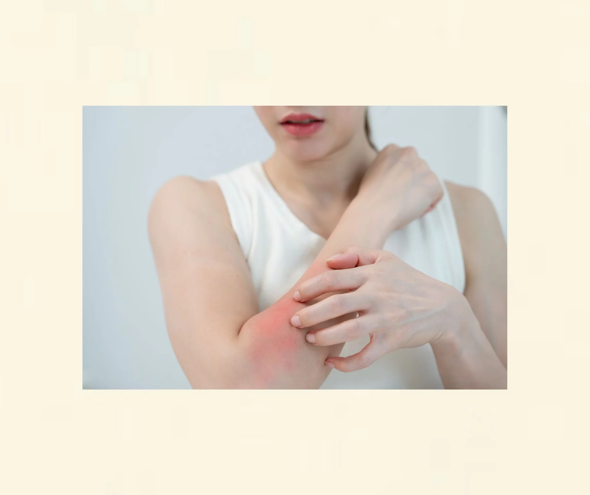 Medizinische Hypnose – Unterstützung bei Hautproblemen, Ekzemen und stressbedingten Hauterkrankungen