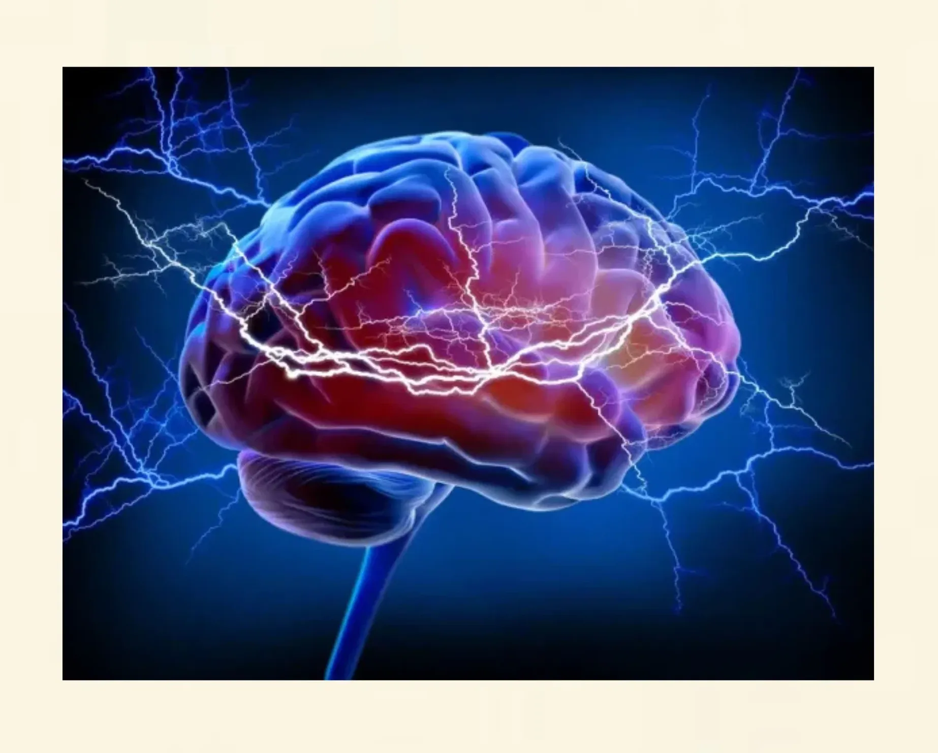 Darstellung des Gehirns zur Erklärung der Wirkung medizinischer Hypnose