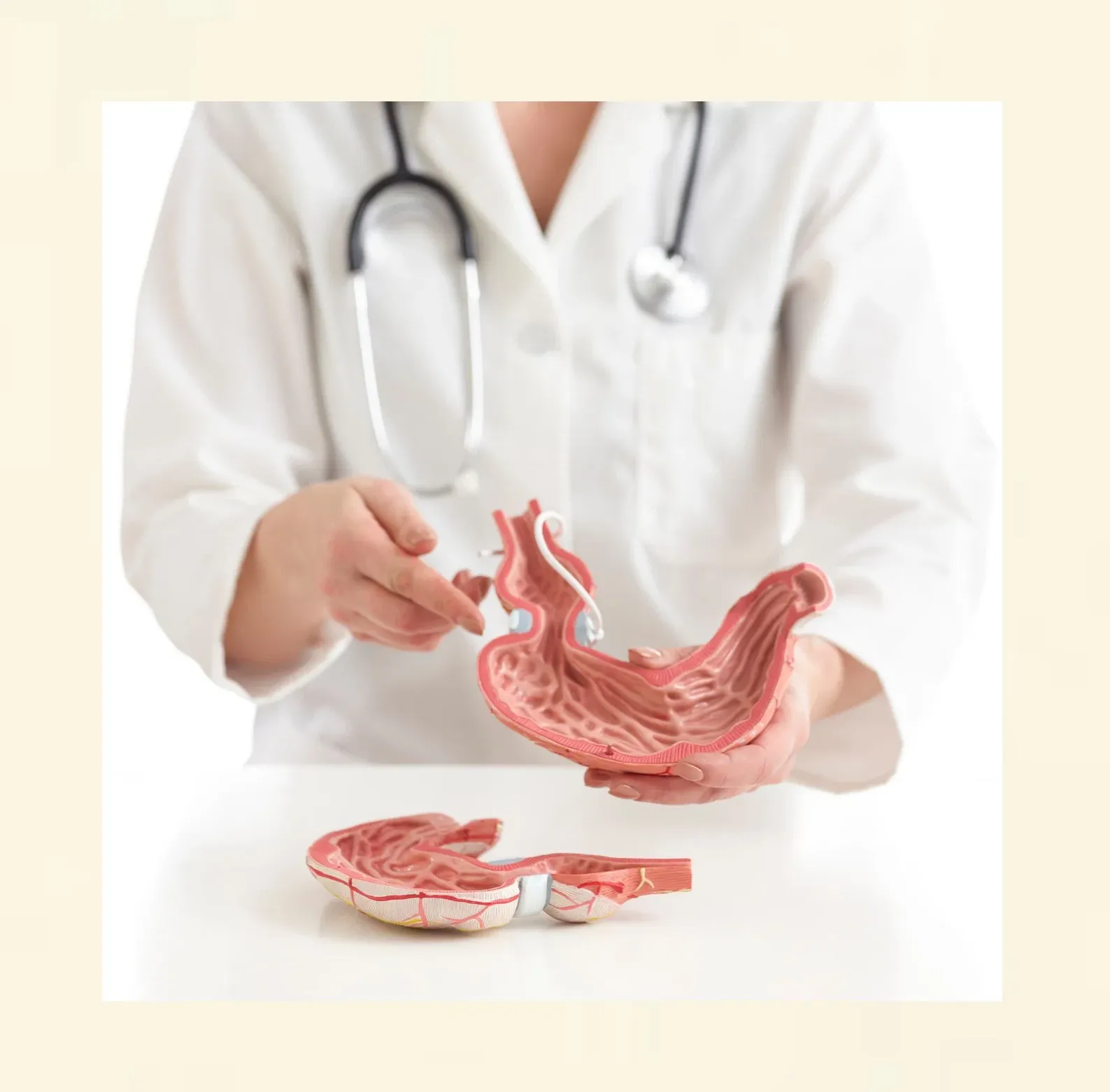 Schematische Darstellung eines Magens mit Magenband – Erklärung des virtuellen Magenbandes in der medizinischen Hypnose in Frauenfeld